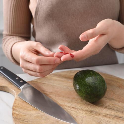 Woman with avocado and cutting board with finger cut by kitchen knife 